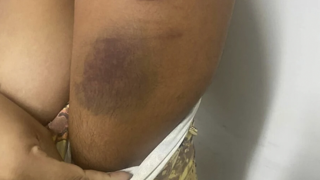 Mulher agredida por marido